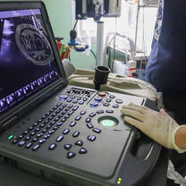LCTW ultrasound